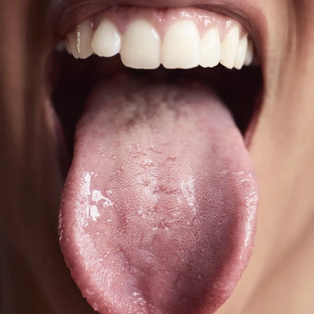 Beauerotisme – MYM creator